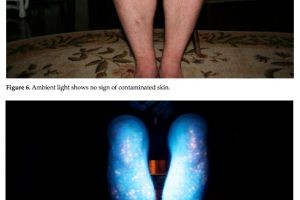UV Contamination