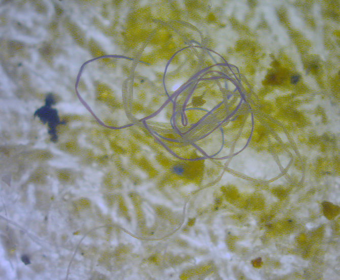 Microplastic fibers from a marine water sample, as seen under magnification. Image: Wikipedia Commons