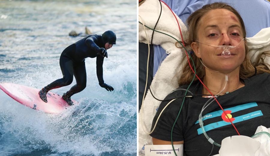 Paddling and River Surf Athlete Brittany Parker Seriously Injured in
