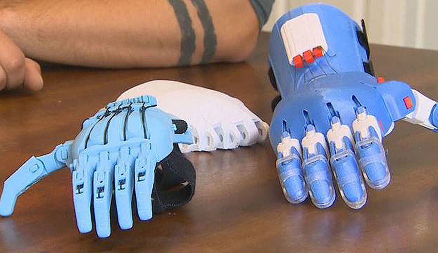 These 3D Printed Prosthetic Hands Are Made With Plastic Found on the
