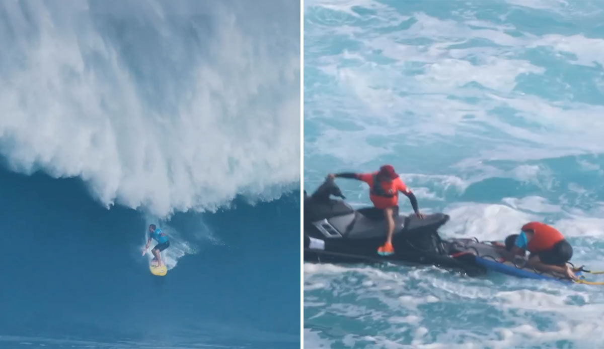 Albee Layer Opens Up About His 2019 Jaws Concussion