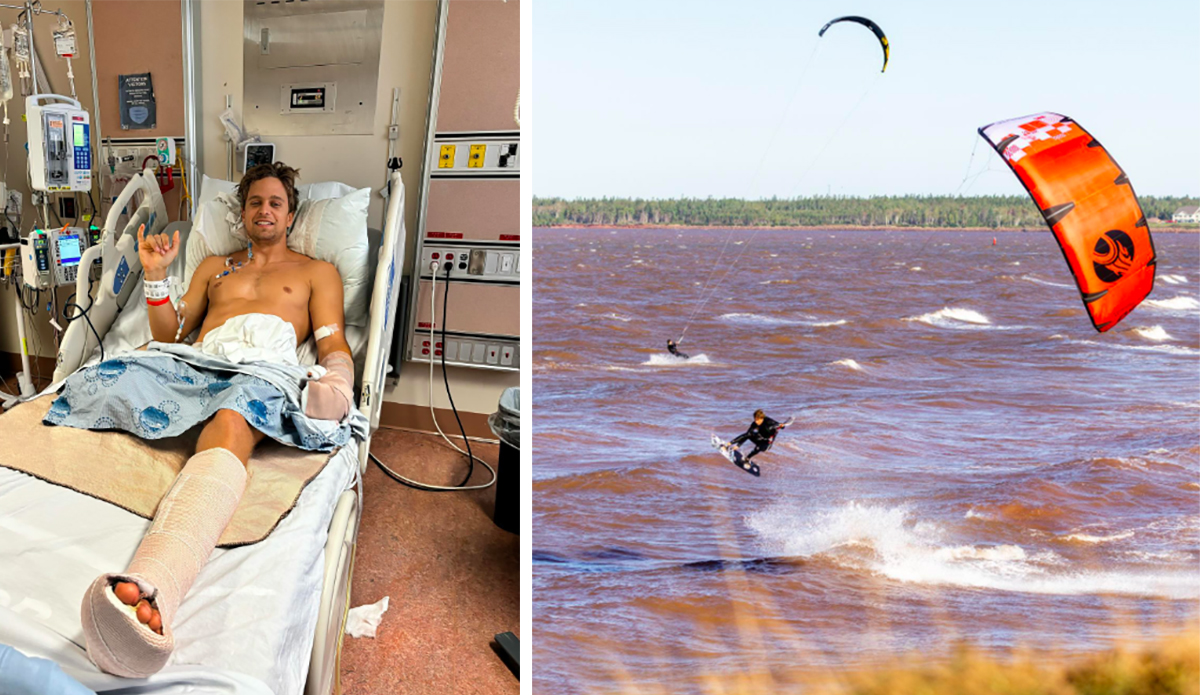 Canadian Kiteboarder in Recovery After Losing Leg in Caribbean Shark Attack