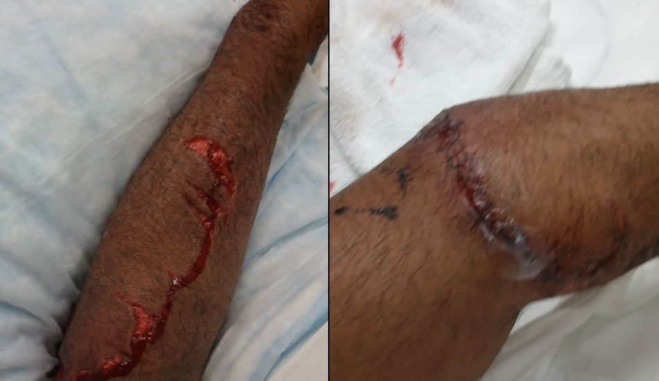 These are the least graphic photos available pre- and post- attack. To view the original photos, check Tupat\'s <a href=\"https://tupat.posterous.com/\" target=\"_blank\">blog.</a>.