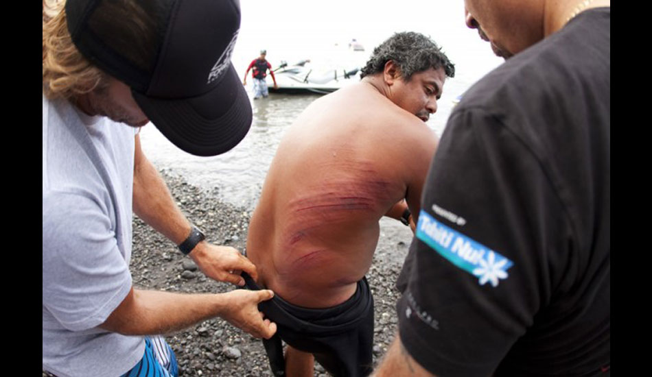 The day didn\'t pass without a few scrapes and scratches. Raimana. Photo: ASP