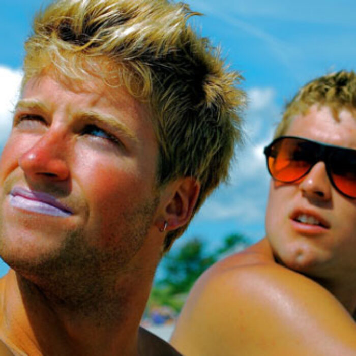 Sunburnt Surfer
