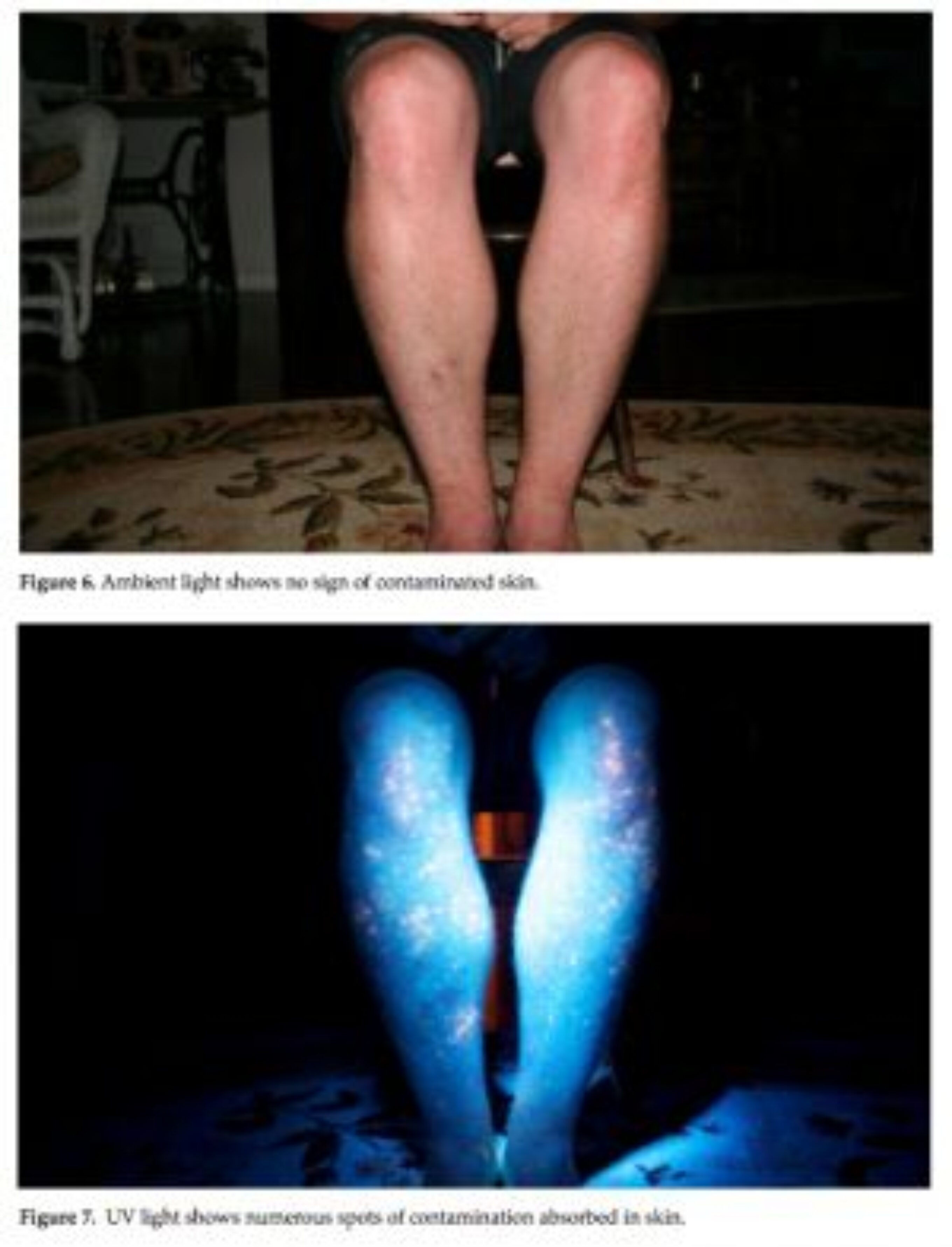 UV Contamination