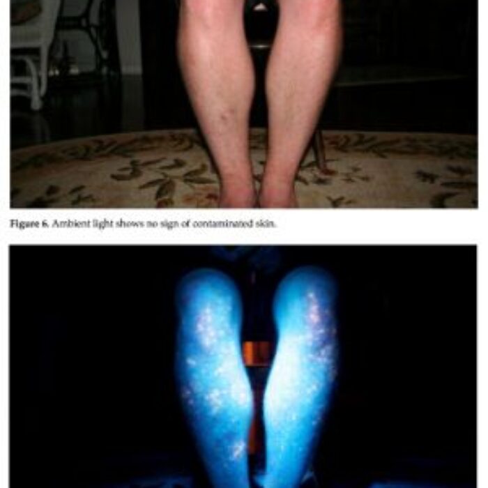 UV Contamination