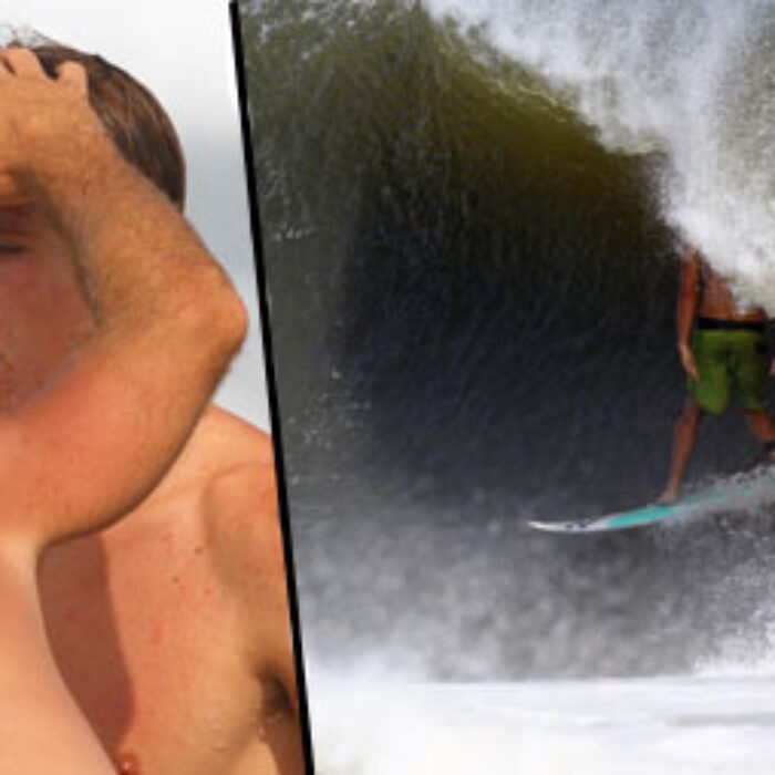 Broken Nose Surfer Blood Barrels Outer Banks
