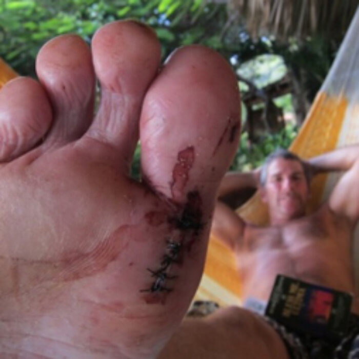 Here are seven tips to help you lower the chances of a surf-related injury.