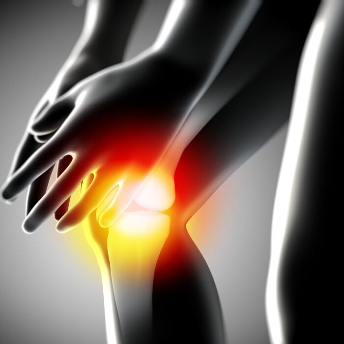 Knee pain...never a good thing. Photo: Shutterstock