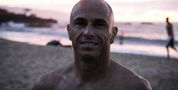 This man does not need hair. Photo: Levin