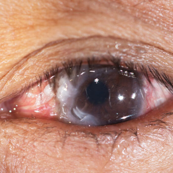 Gross. I want one. Photo: Shutterstock