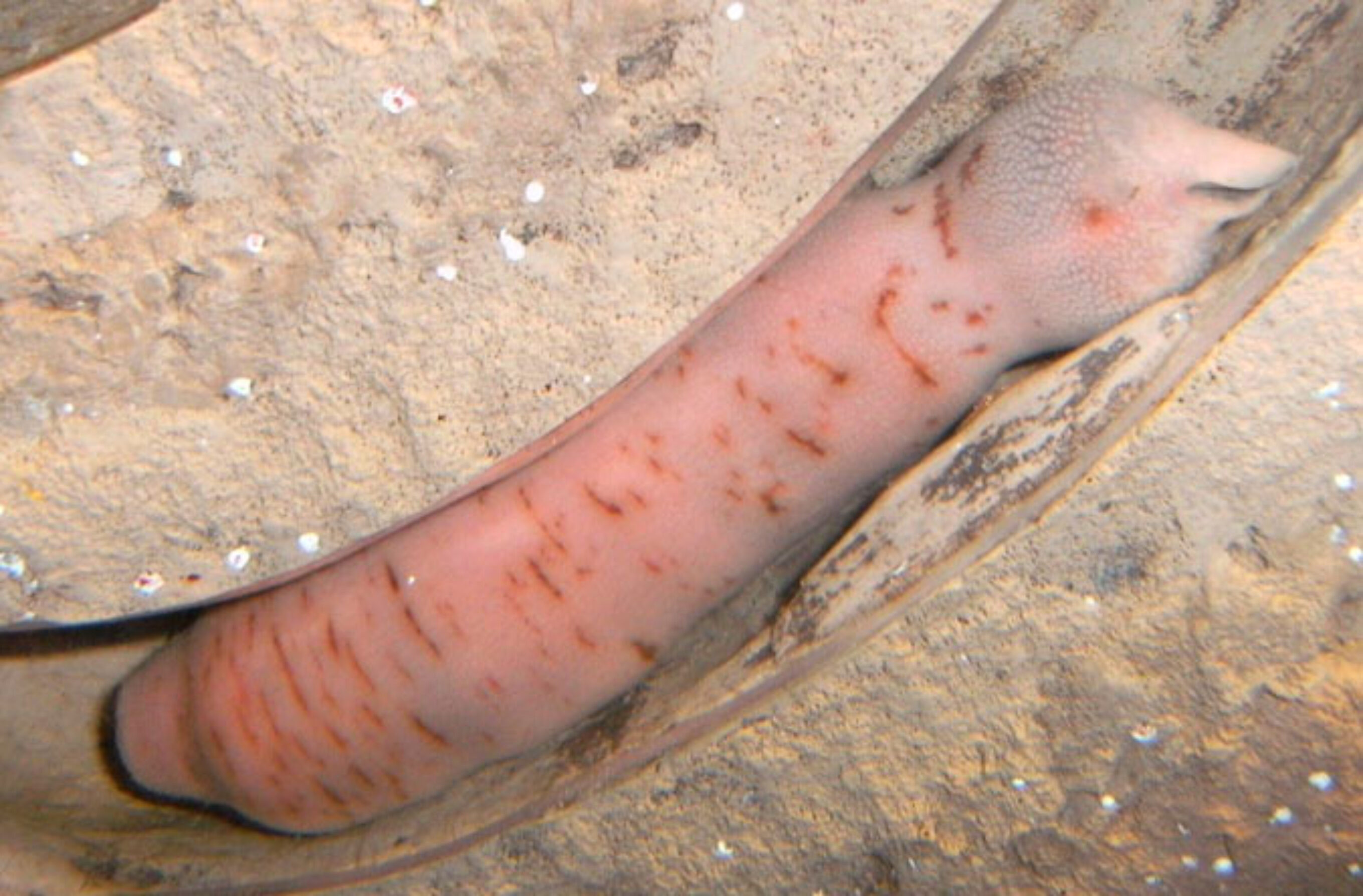 Penis Worm.