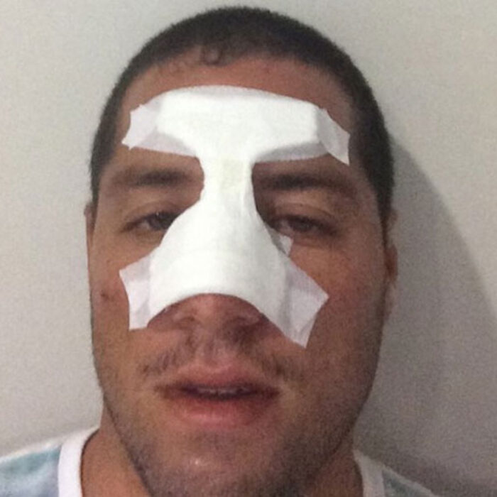 All busted up.