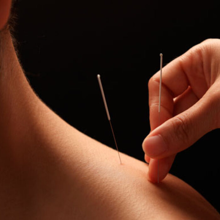 Needles can be good. Very good. Photo: Shutterstock.