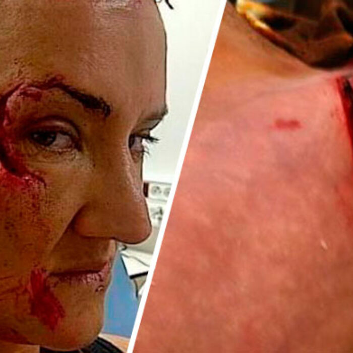 Keala Kennelly and Joel Parkinson's flesh buffets.