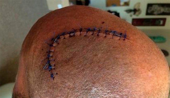 Talk about mental. Photo: Gold Coast Bulletin