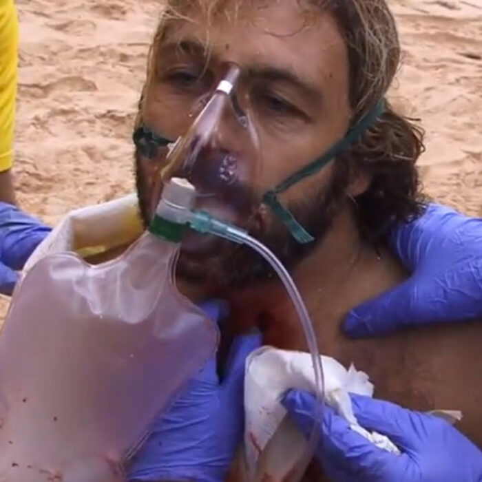 Stabbed in the neck with the surfboard.