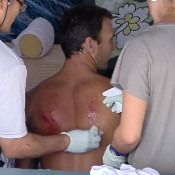 Parko Injured; Out for Sunset