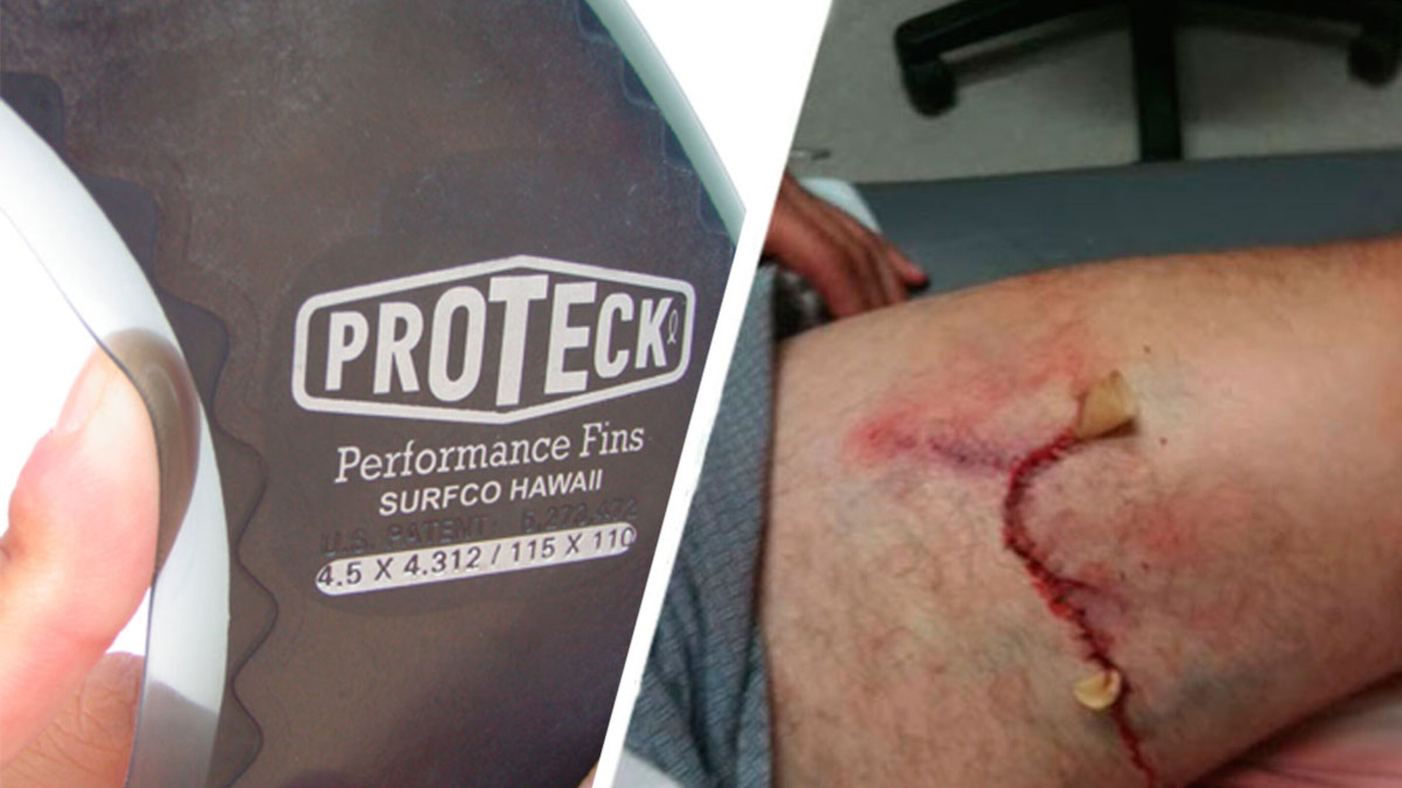 Use Pro Teck Fins and Save Yourself a Trip to the Hospital