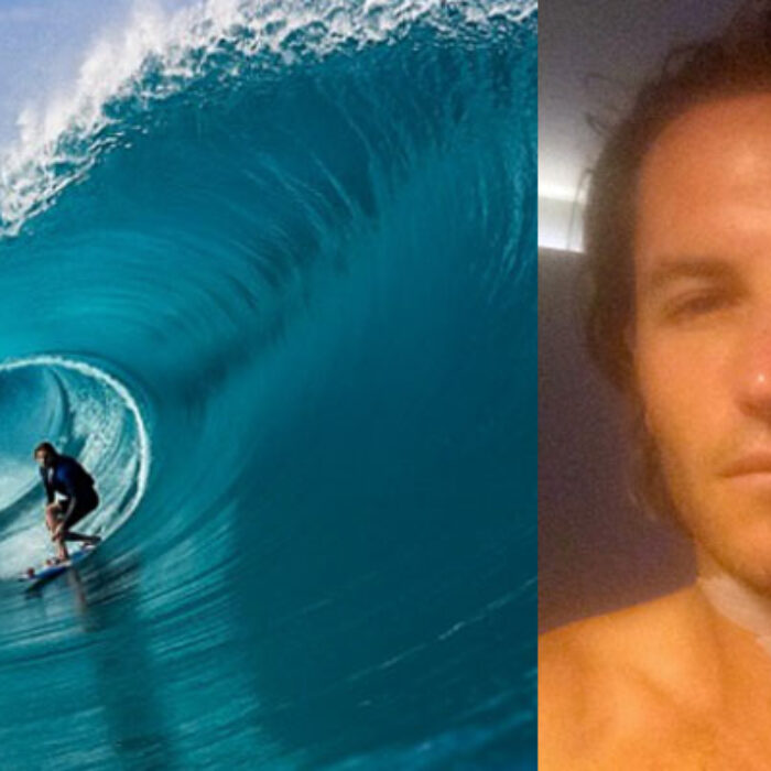 Laurie Towner injured at Teahupoo during Point Break filming.