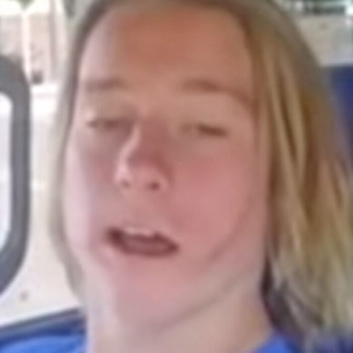 Cody Wisdom Teeth Removal