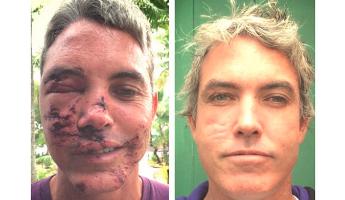 One year later, and all healed up.