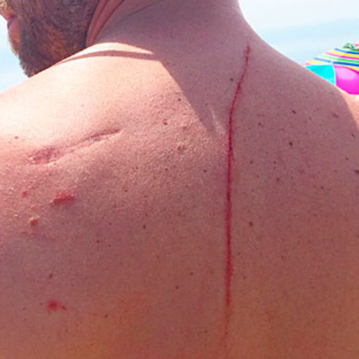 The mark left by the shark.