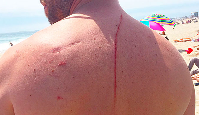 The mark left by the shark.