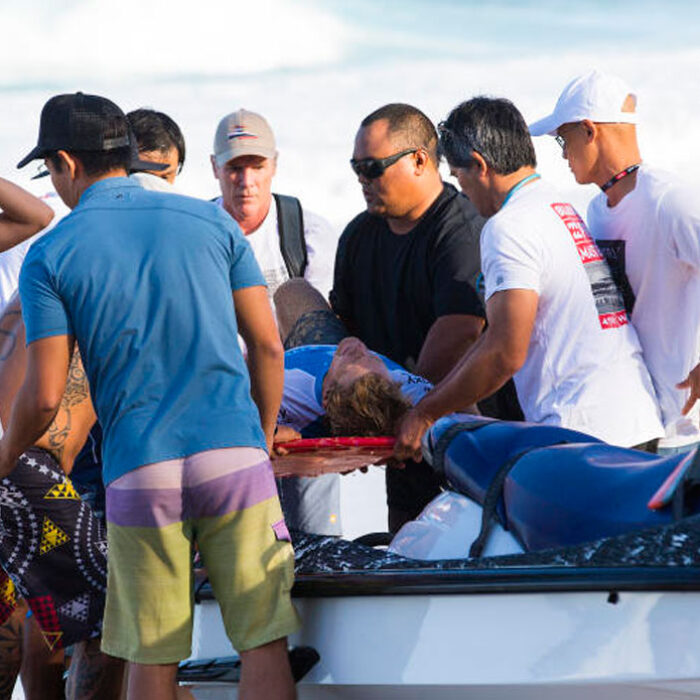 Bede Durbidge Injury