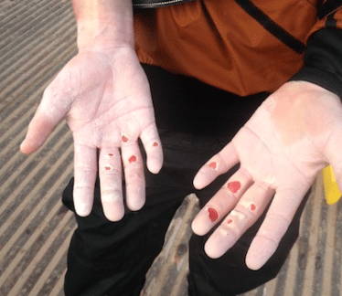 This is what it takes: Casey's hands post run.