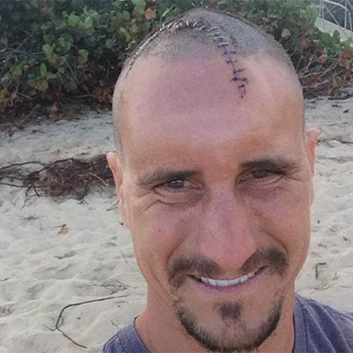 Aaron Gold is a bonafide North Shore charger. It's a dangerous place, though, even on smaller waves. He found that out first hand when he dropped into a Gas Chambers left hander.