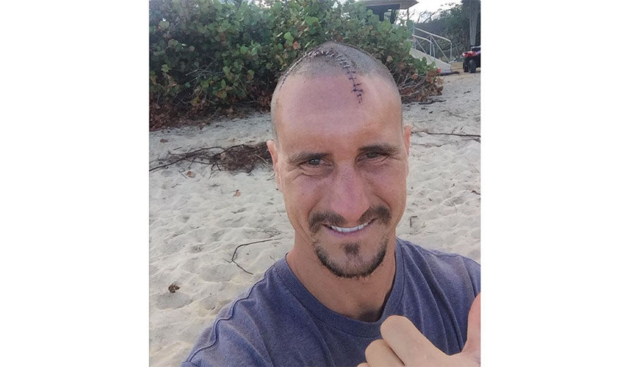 Aaron Gold, stoked and stitched.