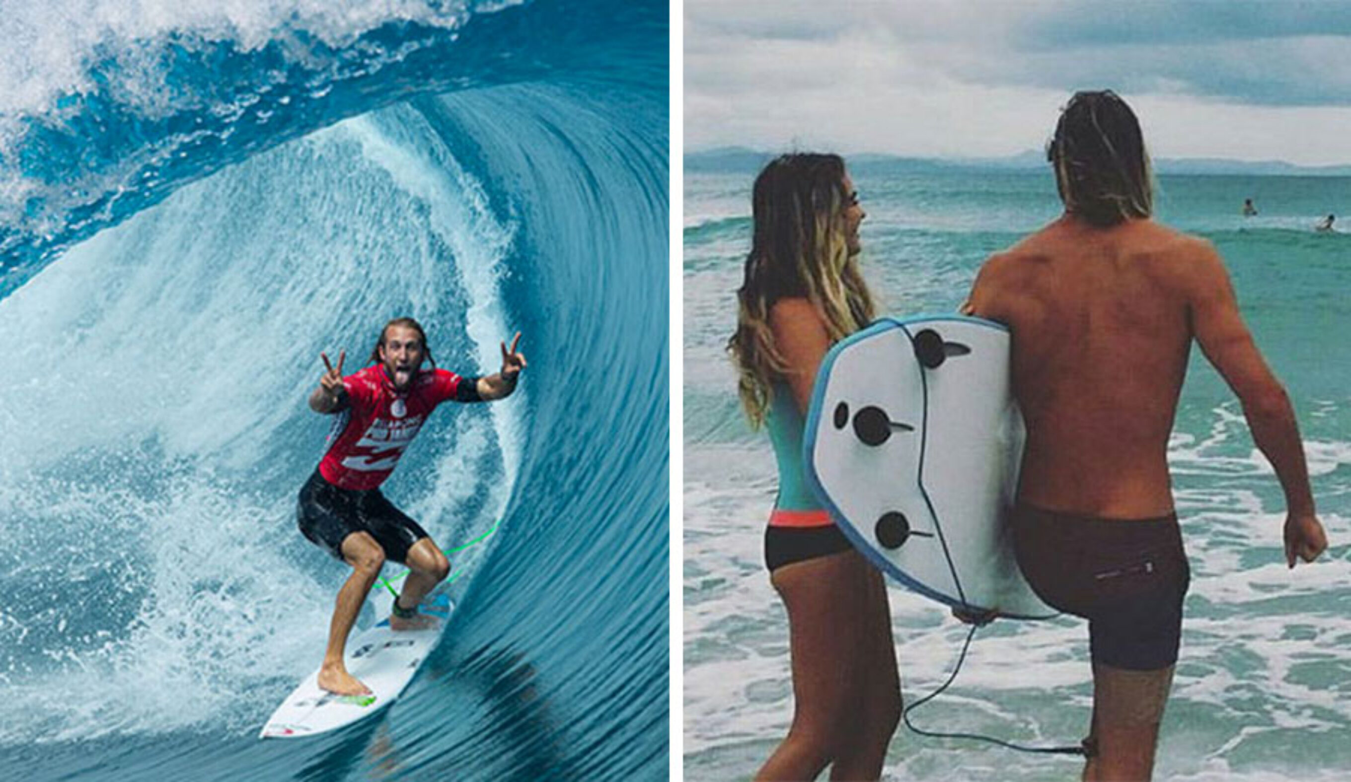 Owen Wright is just beginning a long road to recovery. Photos: WSL/Instagram