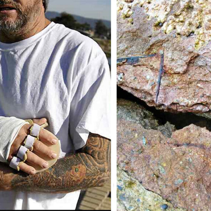 Glenn Harper was impaled by jagged old rebar in the wall at Pleasure Point.