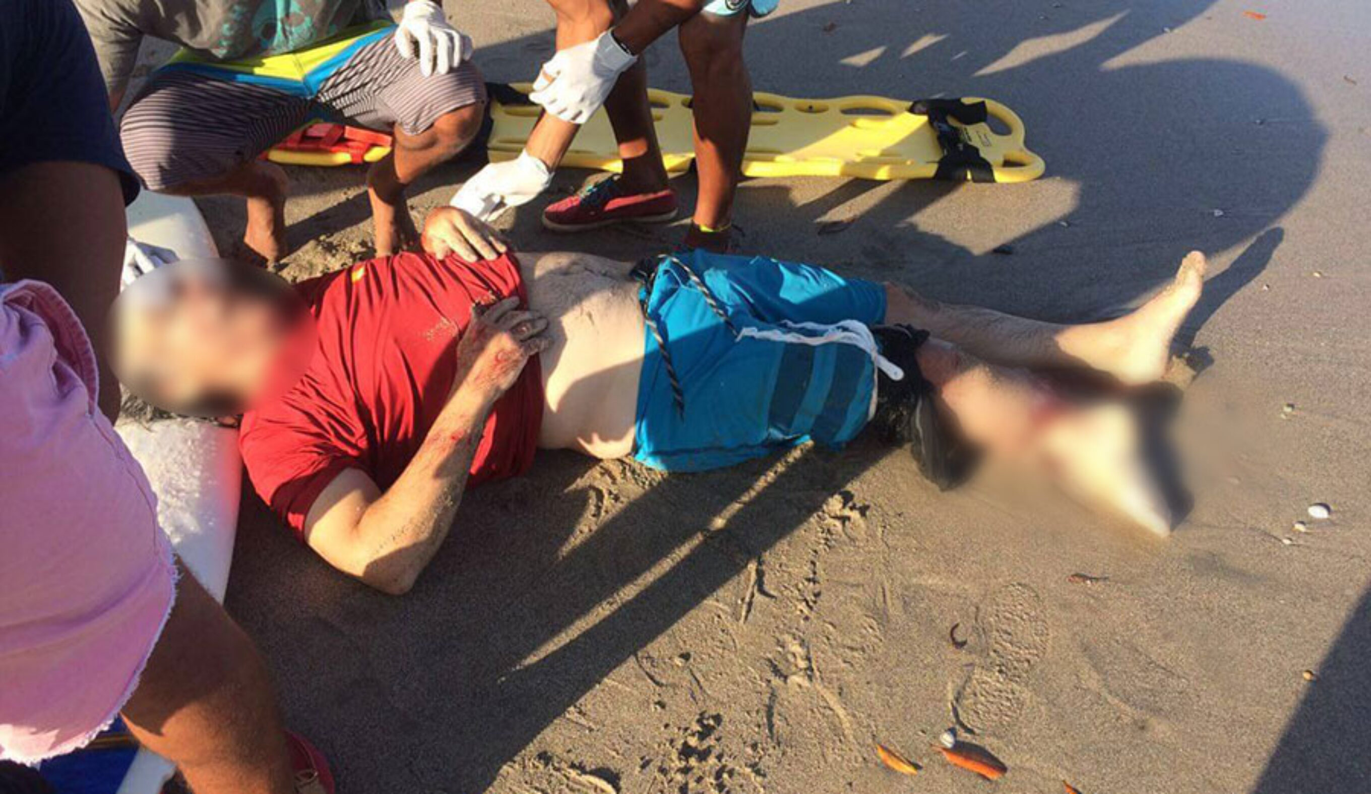 "The victim suffered partial amputation of his right ankle and most of his calf muscle was stripped." Photo: Primero en Noticias