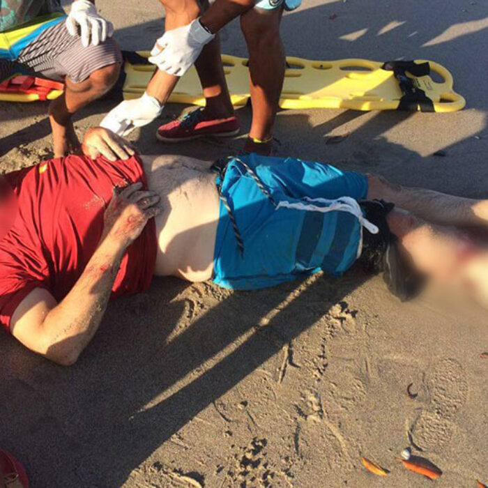 "The victim suffered partial amputation of his right ankle and most of his calf muscle was stripped." Photo: Primero en Noticias