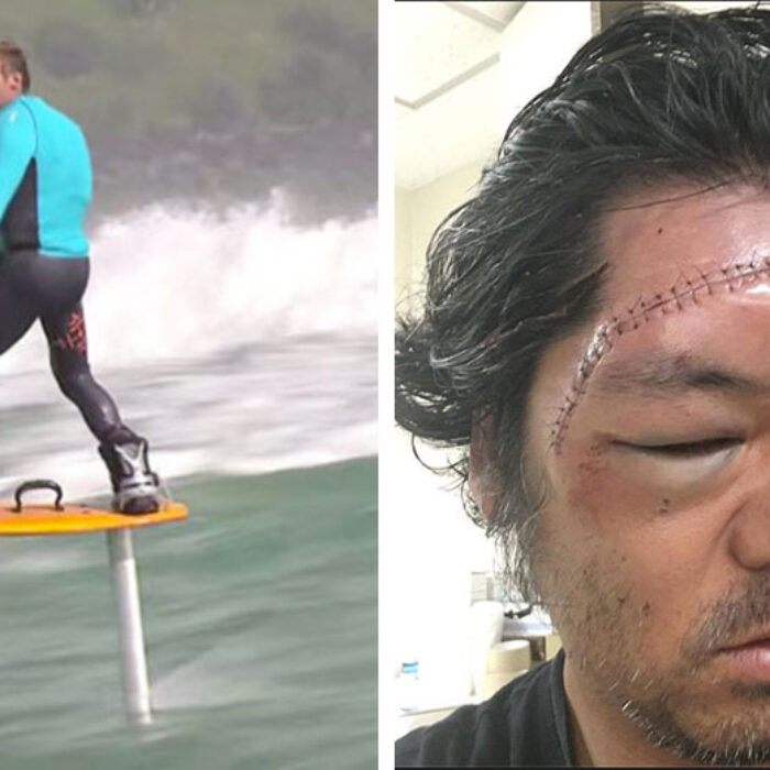 Laird Hamilton, a few years ago on a foil. Recently, a Japanese surfer found out just how dangerous they can be.