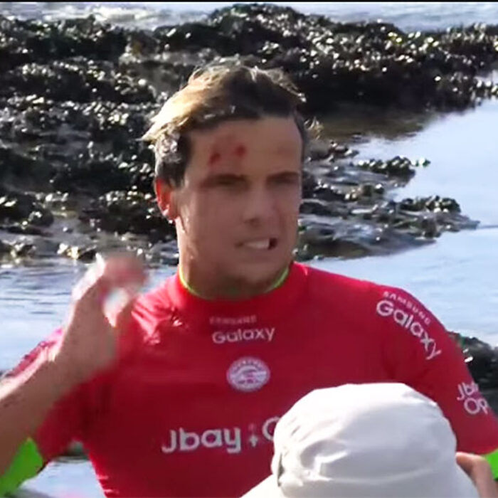 Julian Wilson's a good looking fella... but he almost wasn't!