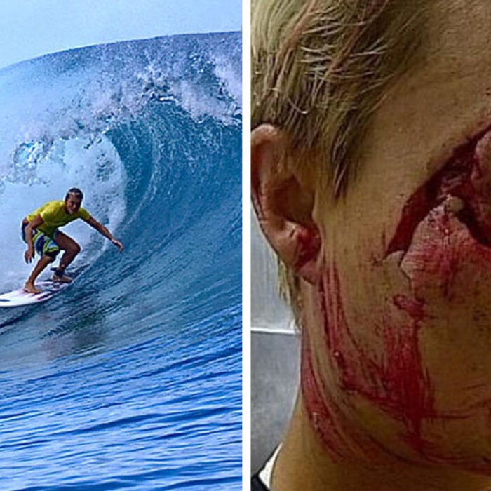 One of surfing's most graphic injuries came from a day at Teahupoo that didn't seem capable of inflicting the kind of damage that it did.