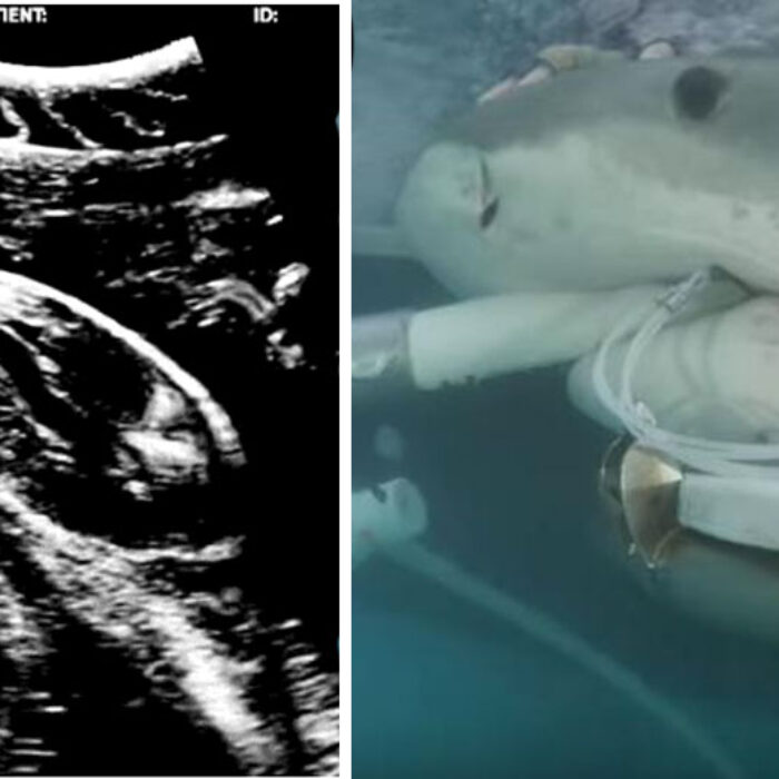 Scientists do some awesome things. Like doing an ultrasound on a pregnant tiger shark.