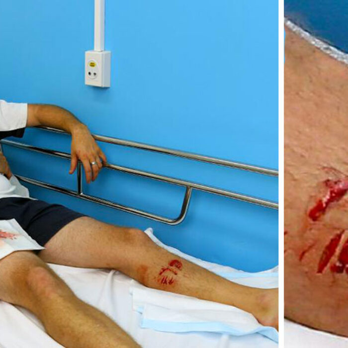 "A bit of duct tape would have sorted me out just fine, thanks." Photos: David Clark/Gold Post Bulletin