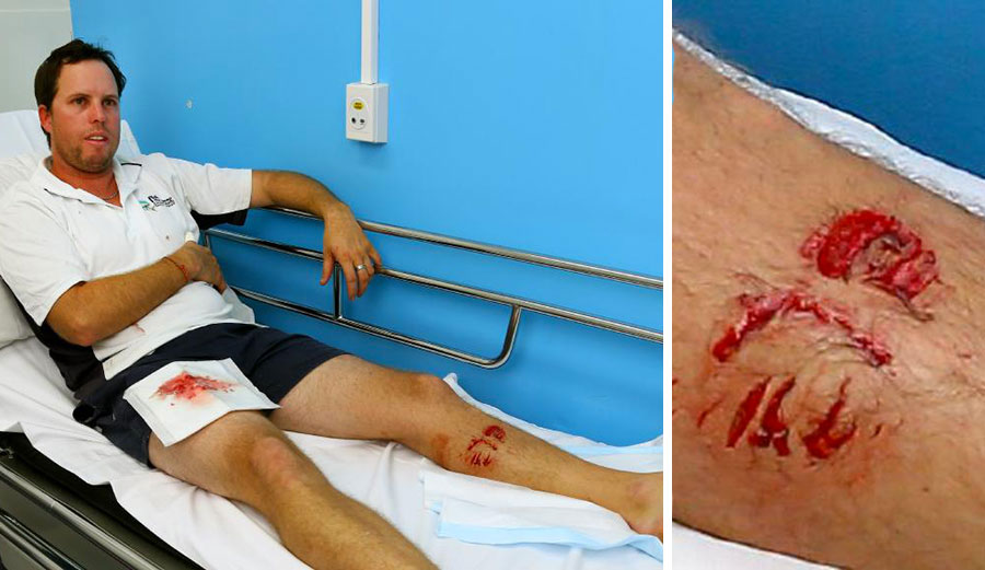 "A bit of duct tape would have sorted me out just fine, thanks." Photos: David Clark/Gold Post Bulletin