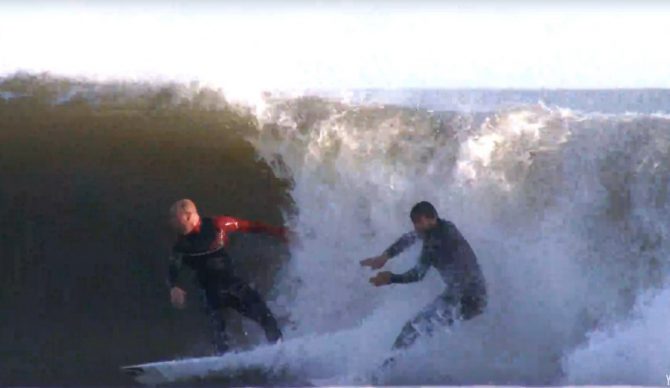 Dane Reynolds, suffering a third-degree burn. Photo: YouTube