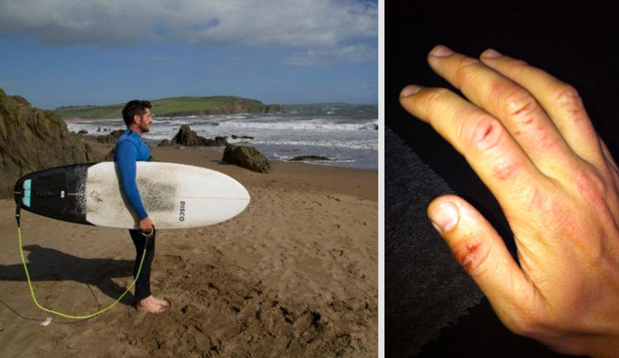 Oh, the humanity! Photos: BBC