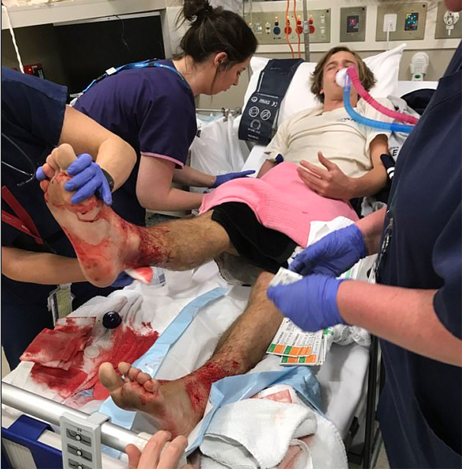 After doctors cleaned him up, they found hundreds of tiny pin-sized holes in his feet and ankles. Image: AAP