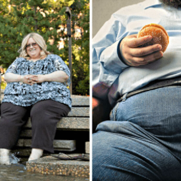 A non-stigmatising image on the left, and a stigmatising image on the right. Canadian Obesity Network/Shutterstock
