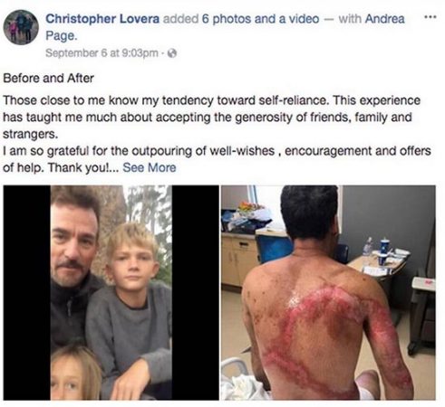 Chris Lovera, Facebook