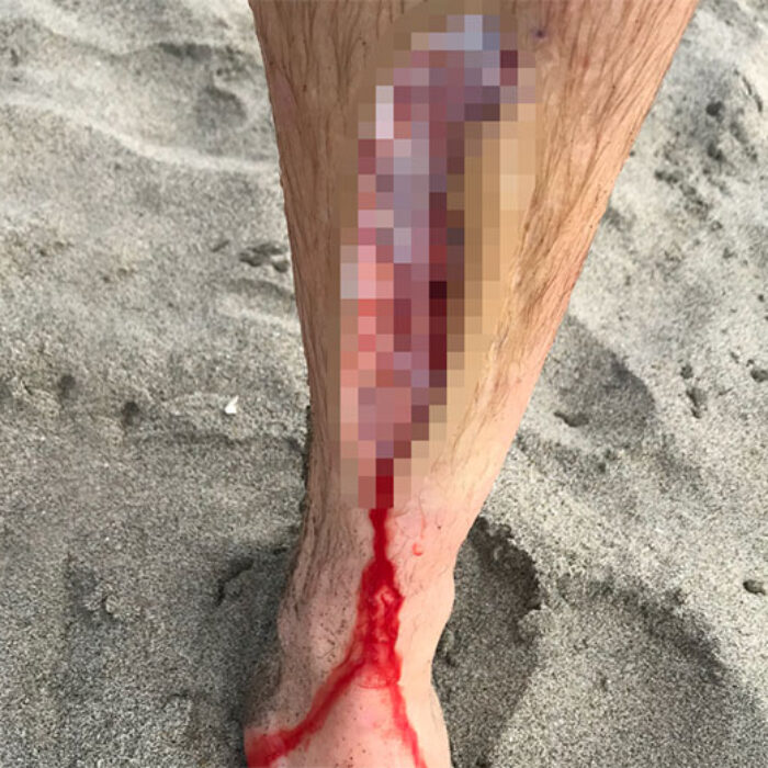 This is a gnarly fin cut. Photo: @tylermccaul
