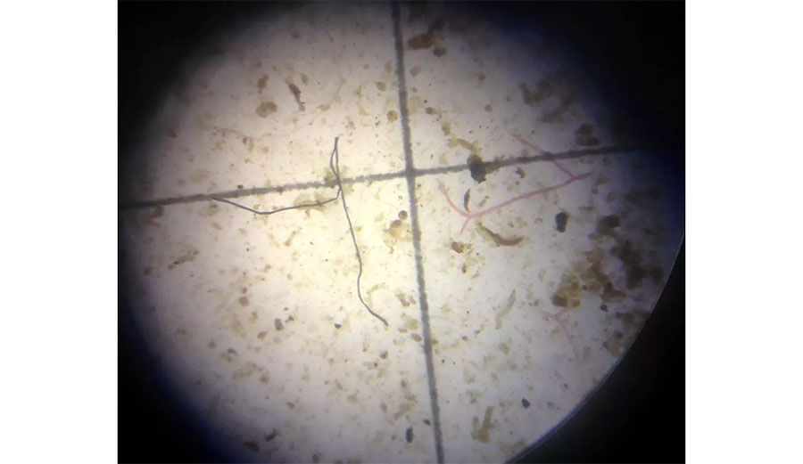 In this, 2017 photo, a possible plastic microfiber is shown through a microscope during an examination of nearby ocean water in Key Largo, Fla. Gulf Coast researchers are preparing to launch a two-year study to see what kinds of microscopic plastics can be found in the waters from south Texas to the Florida Keys. Wilfredo Lee/AP Photo
